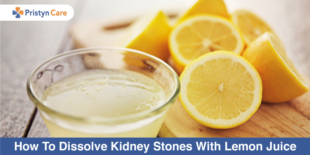 Does Lemon Juice Help Break Up Kidney Stones?
