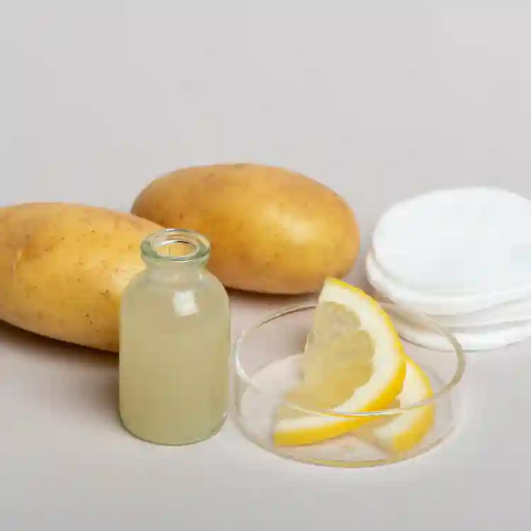 Does Potato Juice Help With Stretch Marks