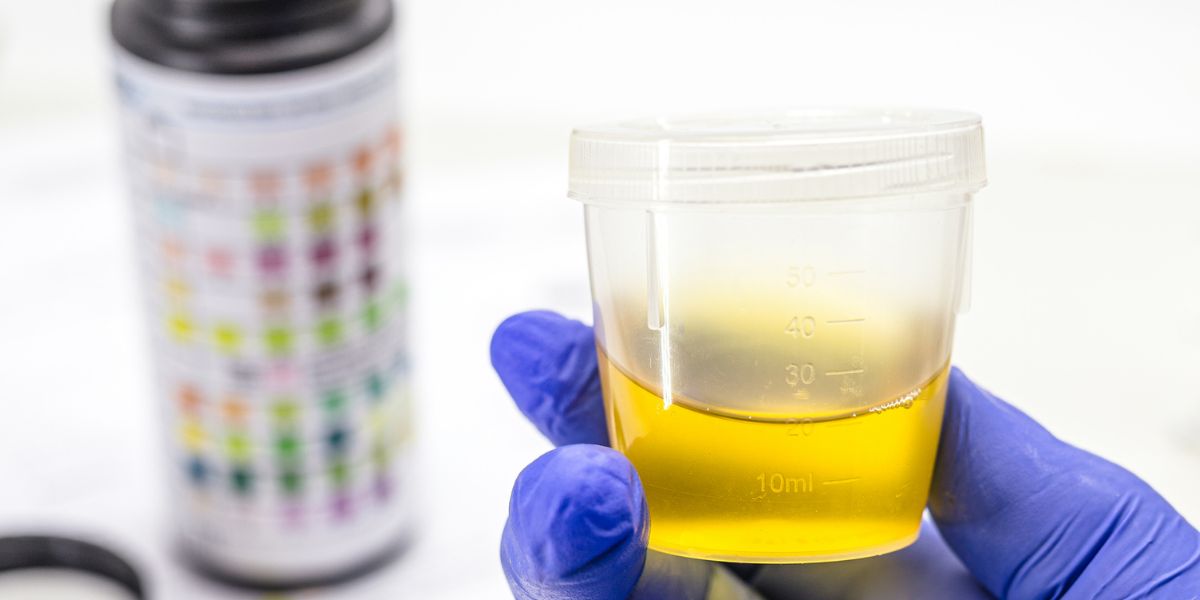 Do Protein Shakes Make You Pee A Lot? Here's the Scoop